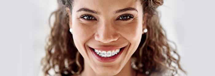 How to Maintain Dental Hygiene with Braces