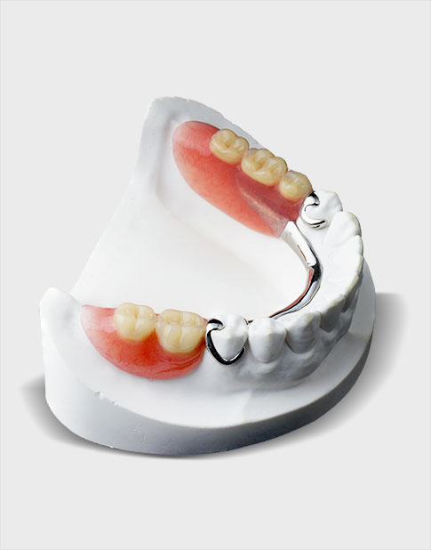 Partial-Dentures