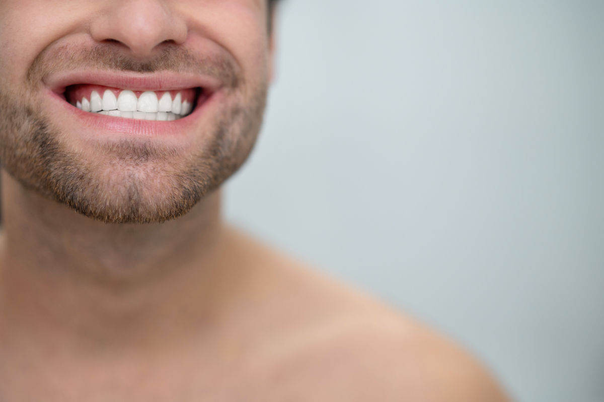 Benefits Of Having Zirconia Veneers