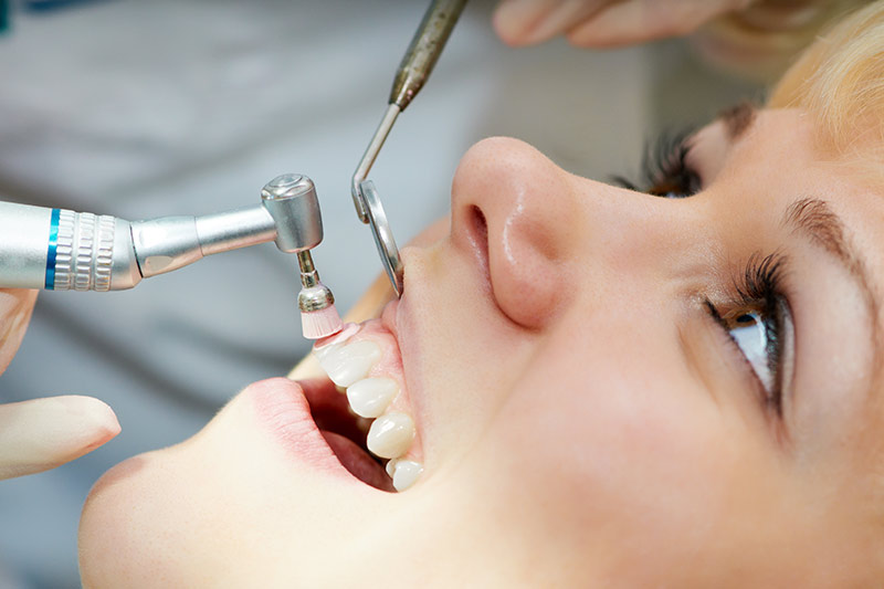 prophylaxis-dental-cleaning-dentist-coral-gables