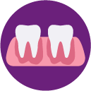 Teeth Laminate
