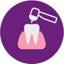 Tooth Surgery