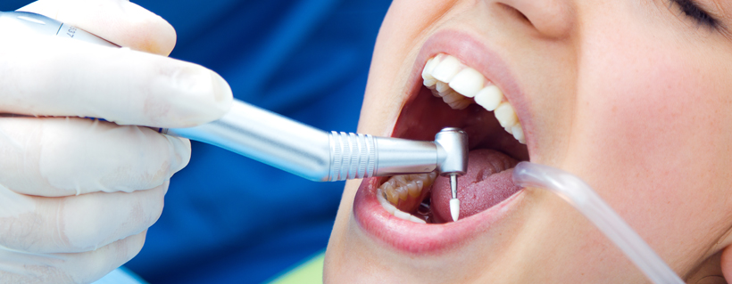 Manila Dental Procedures