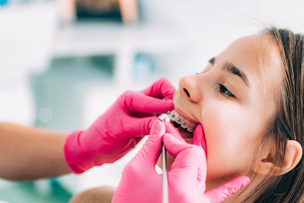 getting braces in the philippines