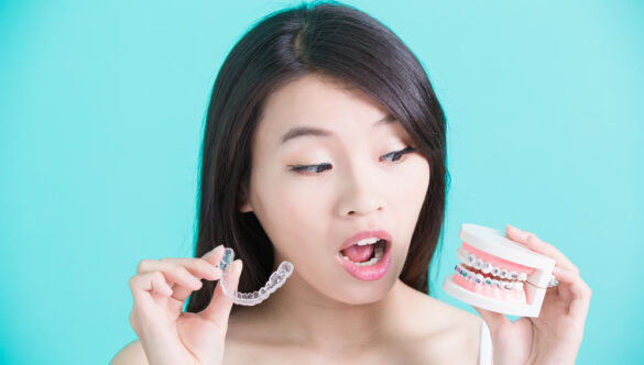 Invisalign in the Philippines: The Process and Cost