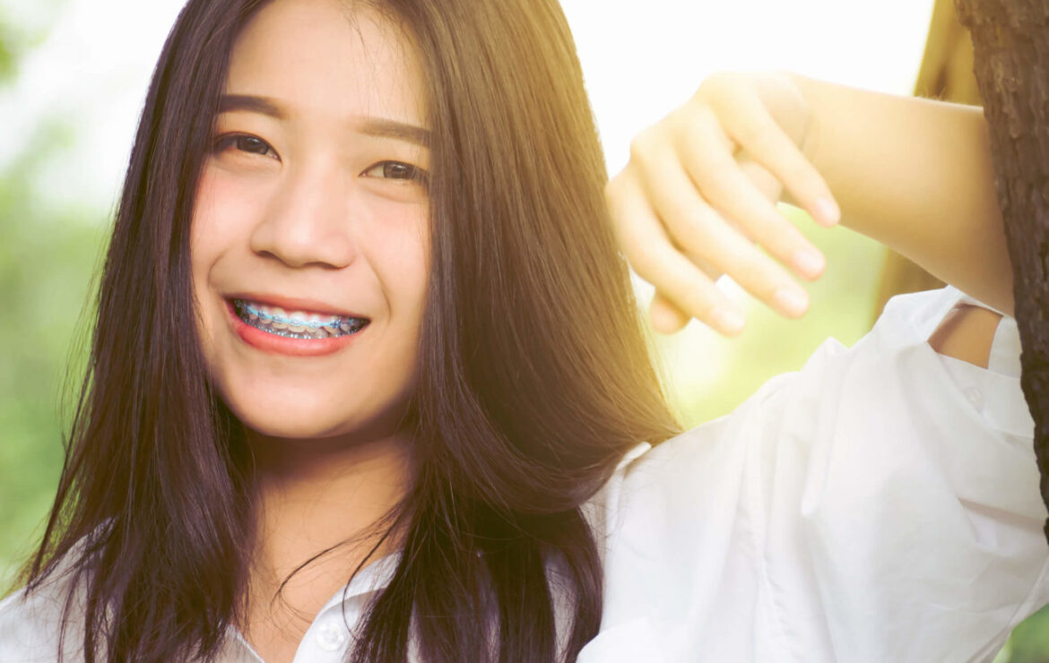 All About Braces: A Simple Complete Guide to Braces in the Philippines
