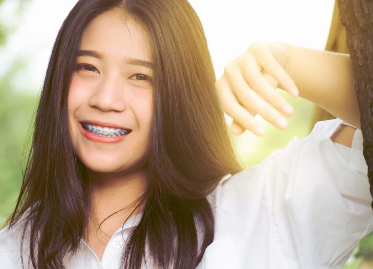 guide to braces in the philippines