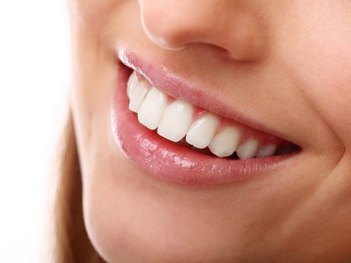 What to Expect During a Zoom Teeth Whitening Procedure