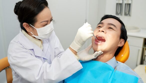 Why Do You Need Dental Veneers?