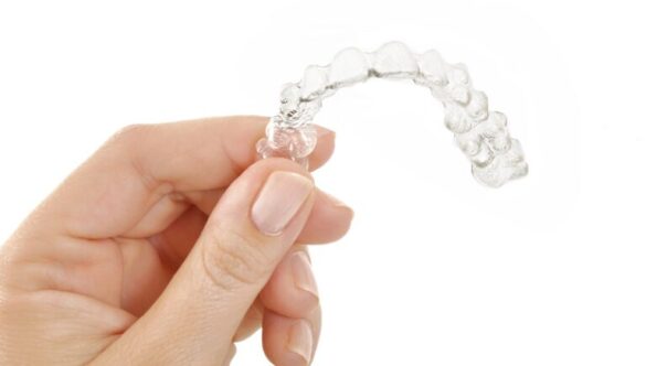 6 Things to Know Before Invisalign