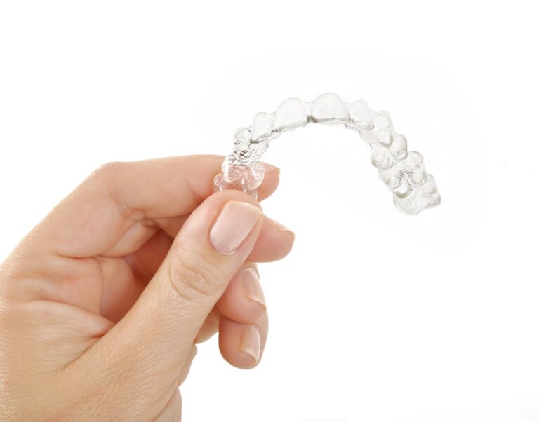 6 Things To Know Before Invisalign 768x602 1