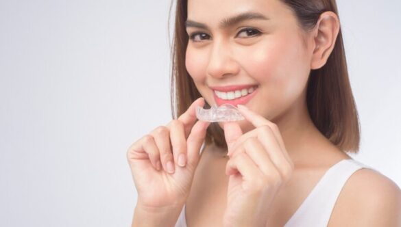 7 Tips for Living with Invisalign