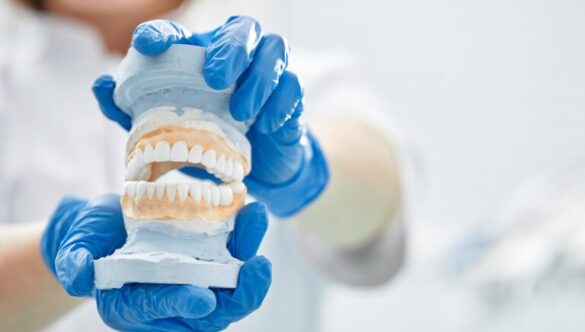 Dental Bridge Vs Implants: Choosing The Best Option