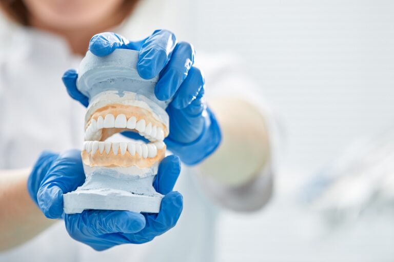 Dental Bridge Vs Implants Choosing The Best Option 768x511 1