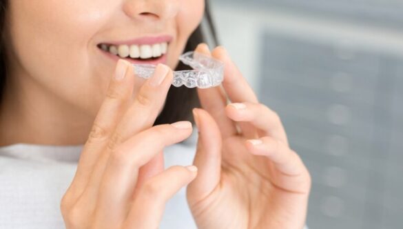 Invisalign Vs Braces: What Are the Differences?