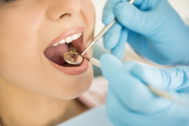 Top 4 Reasons You Need A Dental Bridge 768x513 1