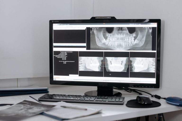 Dental Xray 768x512b