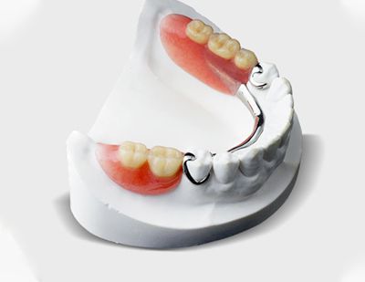 Service Thumb Removal Partial Dentures