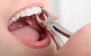 Dental Procedures In The Phlippines