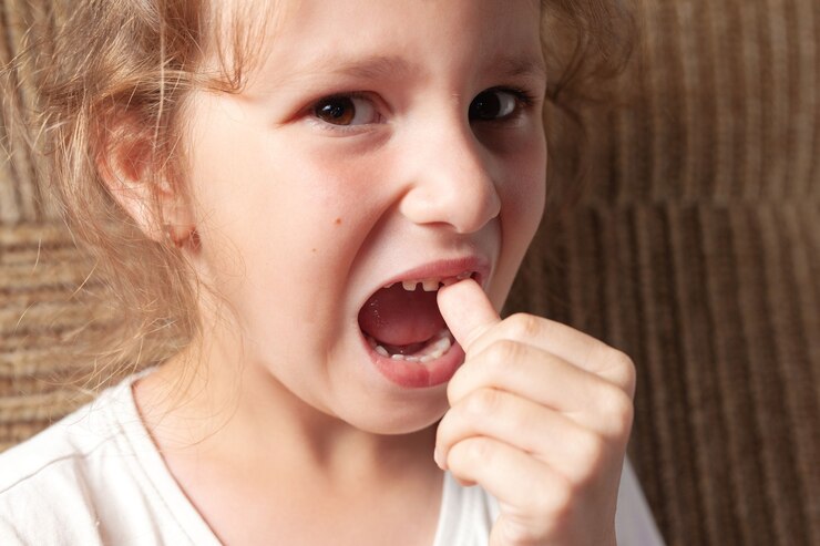 6 Disadvantages Of Having Teeth Gaps