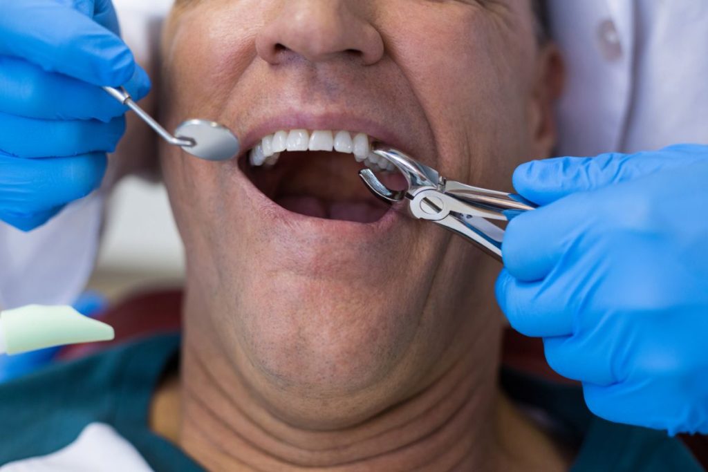 Dentist Using Surgical Pliers To Remove A Decaying 2021 08 28 16 45 02 Utc 1024x683