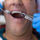 A Guide To Tooth Extraction Aftercare