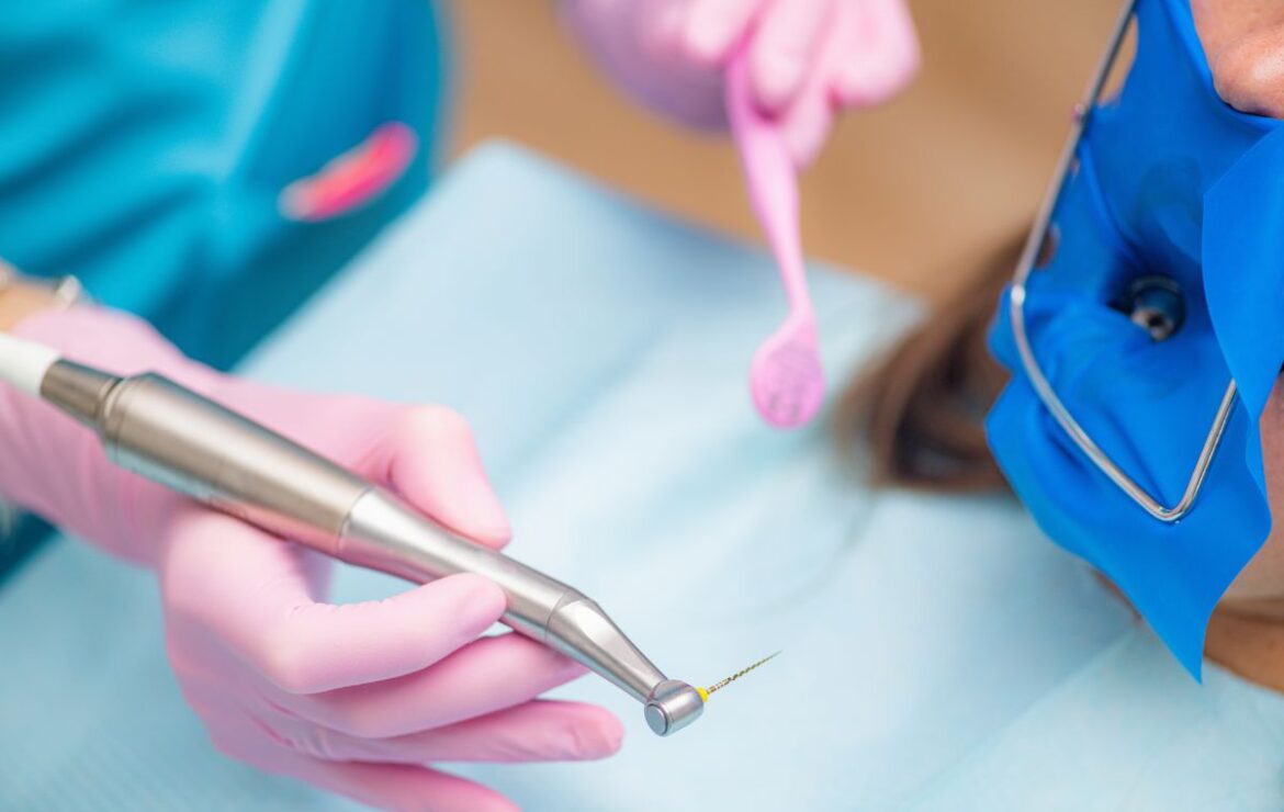 Root Canal Post-Treatment Tips