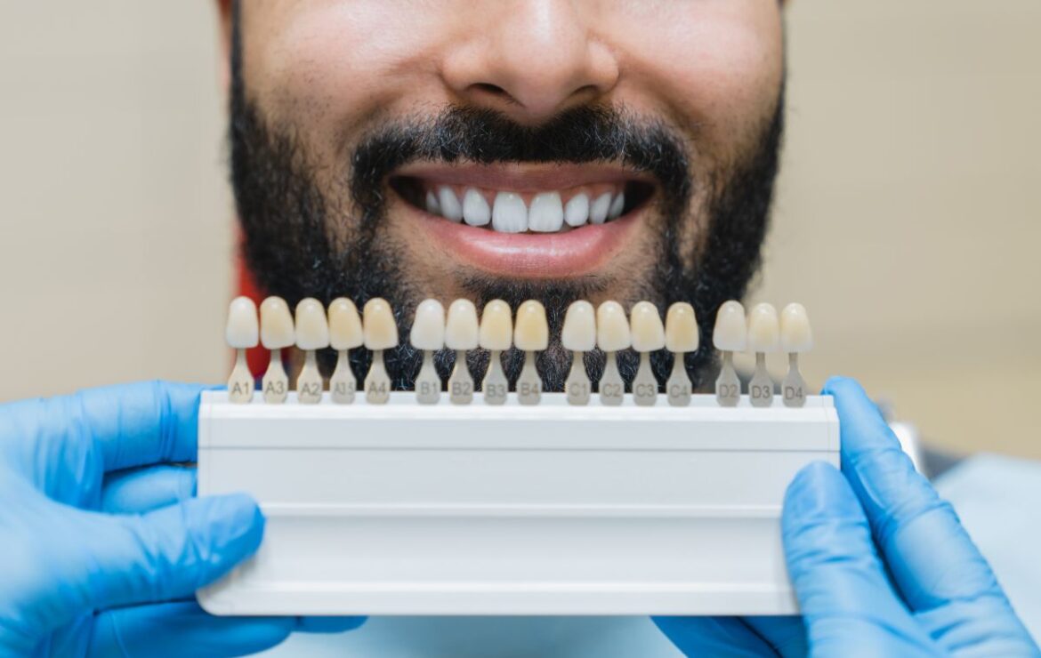 3 Types Of Dental Veneers