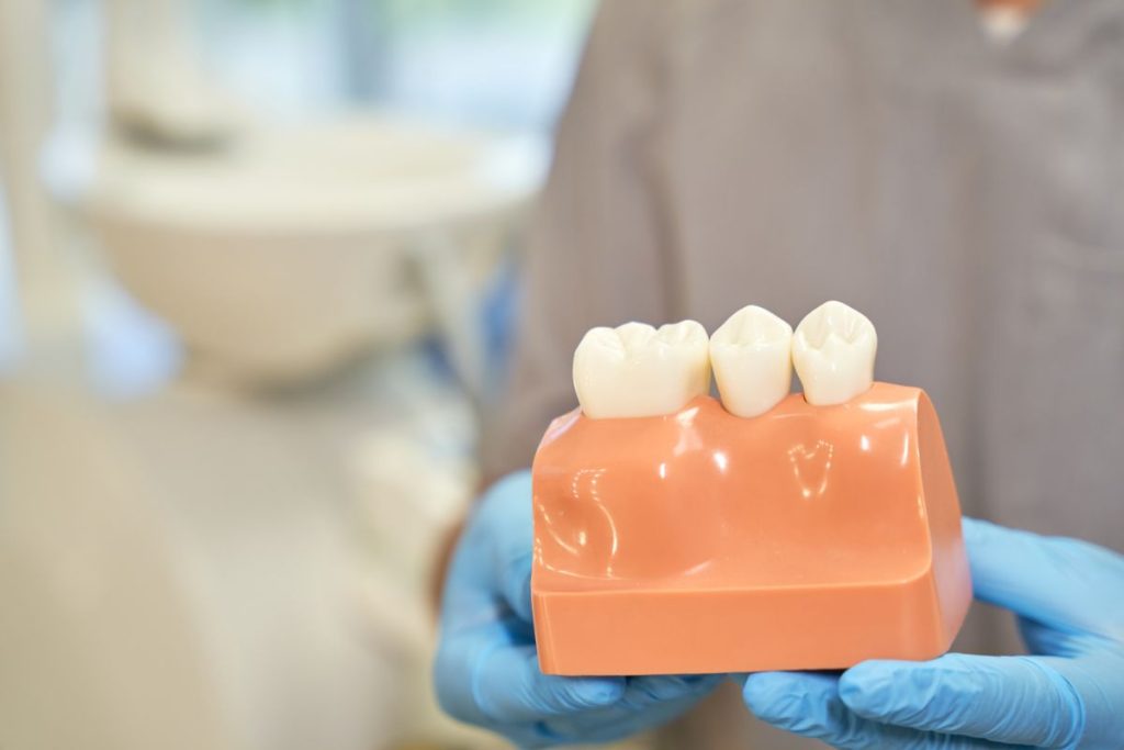 Visual Plastic Prop Of Gum And Teeth Presented By 2022 09 29 20 18 07 Utc 1024x683