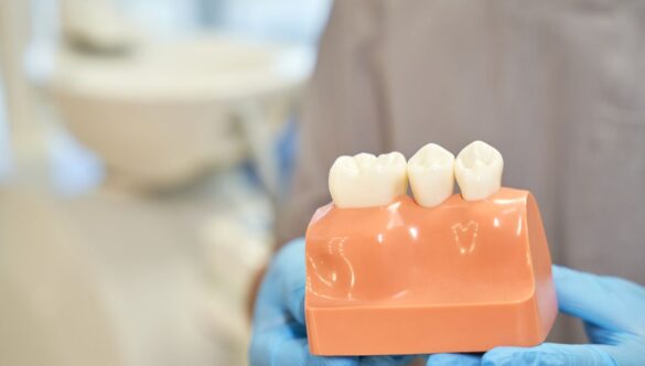 Why Airflow Treatment Is Much Better For Your Gums?