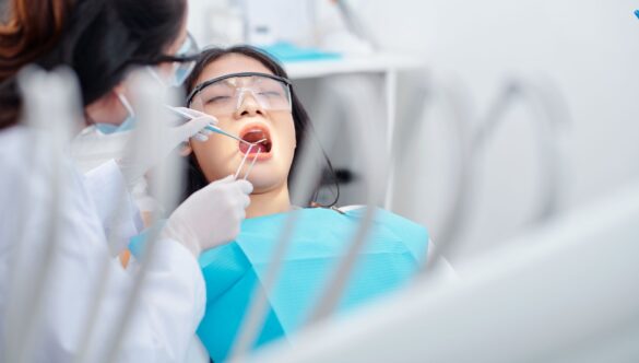 6 Benefits Of Dental Sealants
