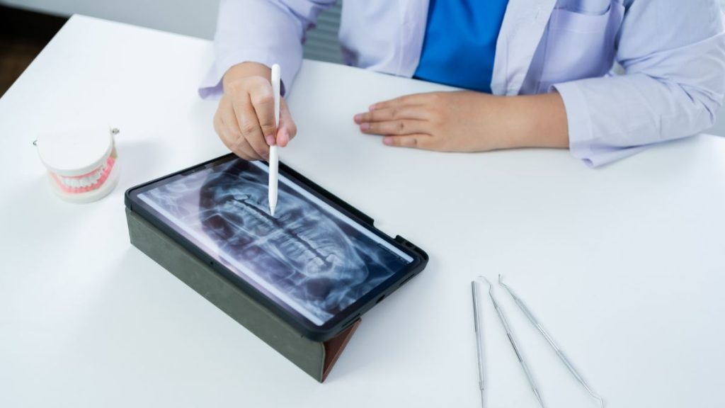6 Benefits Of Dental X-Rays
