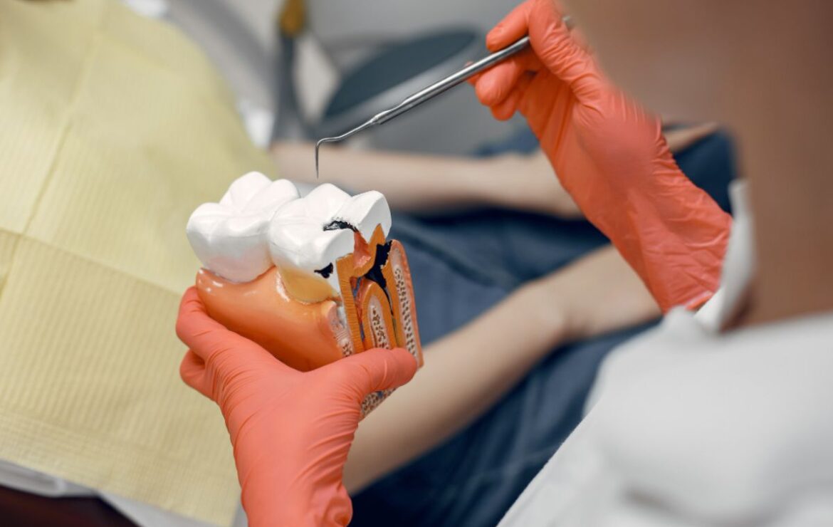 5 Symptoms of Cavities in Teeth