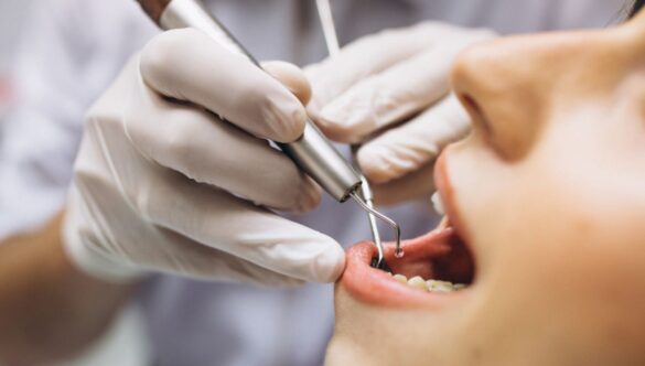 5 Reasons You Should Get Dental Cleaning