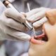 5 Reasons You Should Get Dental Cleaning