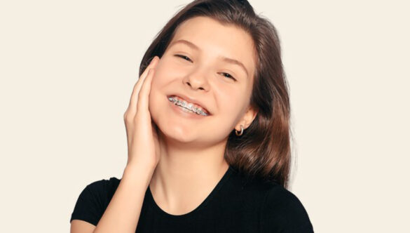 5 Essential Tips for Taking Care of Your Braces