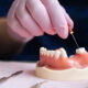 Root Canal Treatment Myths: Unveiling the Facts
