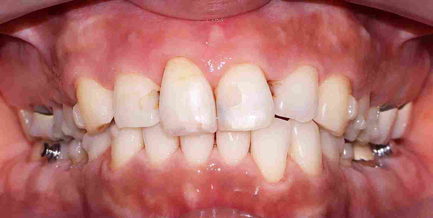 Service AirFlow BnA After 11zon