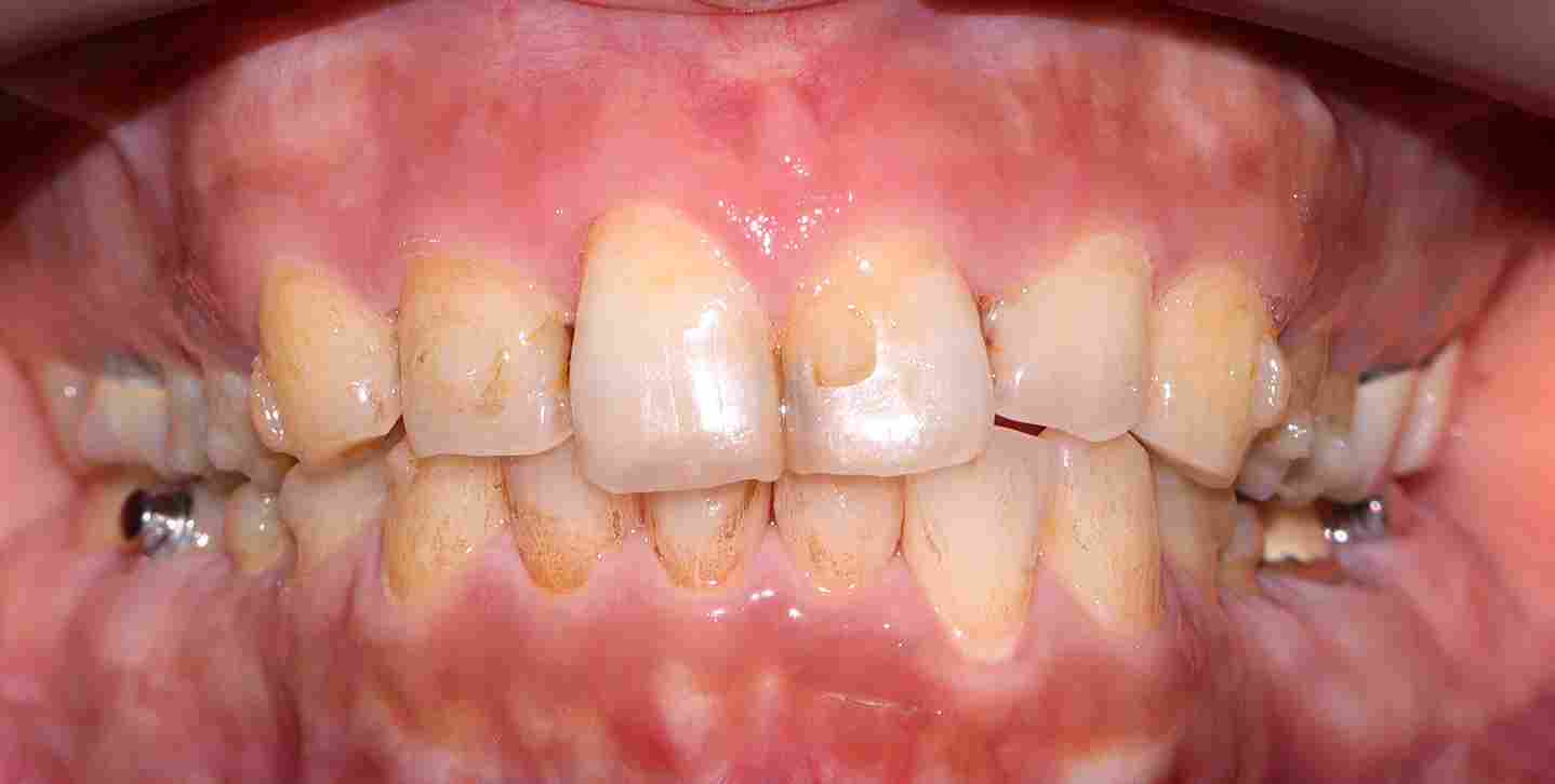 Service AirFlow BnA Before 11zon