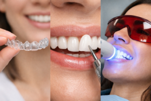 Invisalign, Veneers, or Whitening? Choosing the Right Smile Upgrade for Your Lifestyle