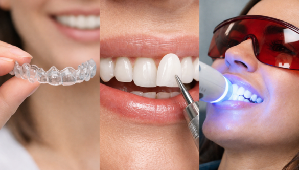 Invisalign, Veneers, or Whitening? Choosing the Right Smile Upgrade for Your Lifestyle