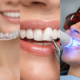 Invisalign, Veneers, or Whitening? Choosing the Right Smile Upgrade for Your Lifestyle