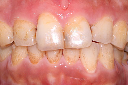 airflow-bna1-before