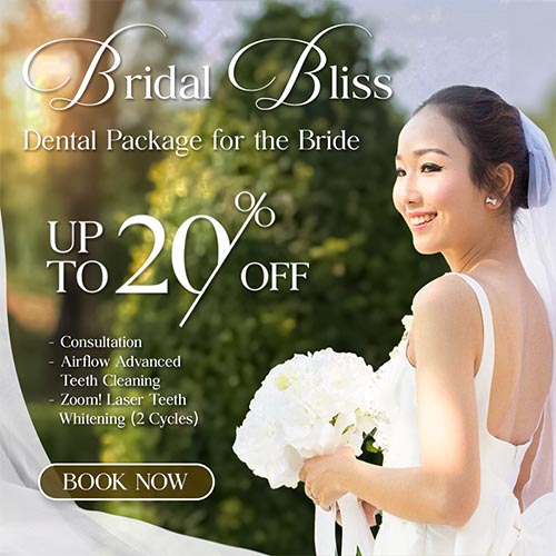 Say “I Do” with a Perfect Smile!