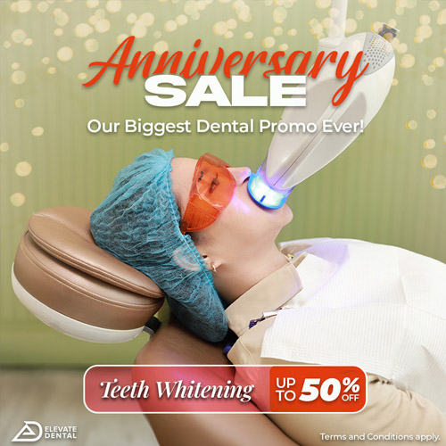 Exclusive Discounts on Veneers, Teeth Whitening and More!