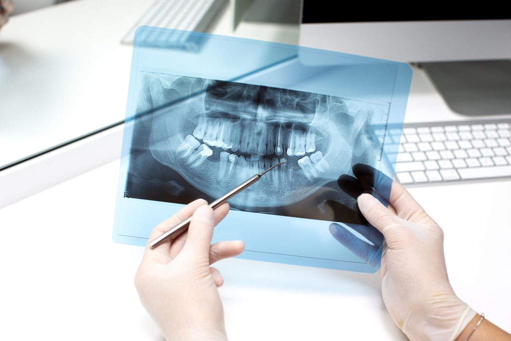 dentist showing a dental X-ray to a patient while choosing a dental practice focused on clear communication and informed care