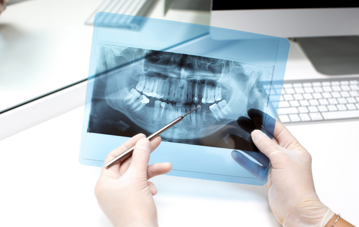 Choosing a Dental Practice That Prioritizes Comfort, Privacy, and Precision
