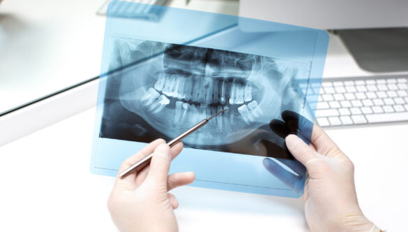 Choosing A Dental Practice Scaled