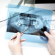 Choosing a Dental Practice That Prioritizes Comfort, Privacy, and Precision