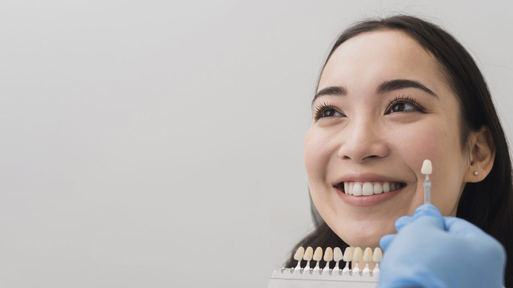 lifespan of dental veneers